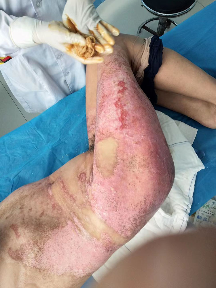 k8凯发官网(中国)天生赢家·一触即发