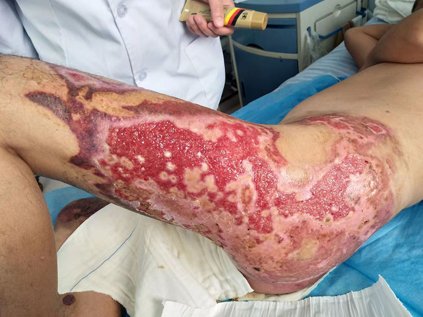 k8凯发官网(中国)天生赢家·一触即发