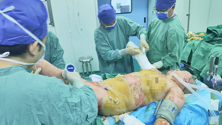 k8凯发官网(中国)天生赢家·一触即发