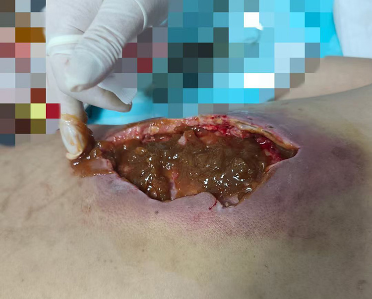 k8凯发官网(中国)天生赢家·一触即发