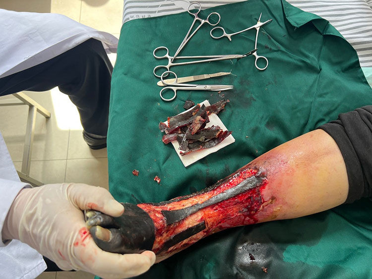 k8凯发官网(中国)天生赢家·一触即发