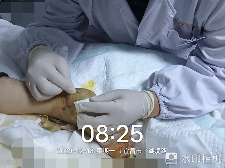 k8凯发官网(中国)天生赢家·一触即发