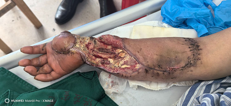 k8凯发官网(中国)天生赢家·一触即发