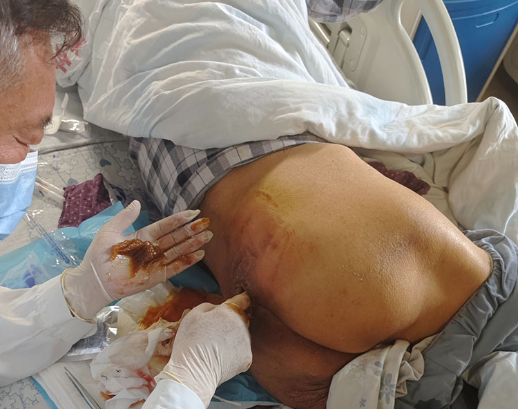 k8凯发官网(中国)天生赢家·一触即发