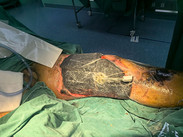 k8凯发官网(中国)天生赢家·一触即发