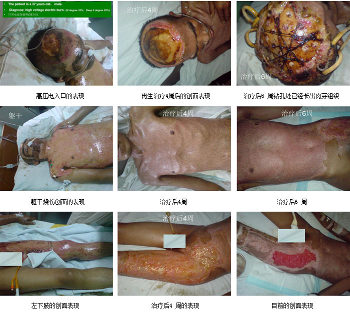k8凯发官网(中国)天生赢家·一触即发