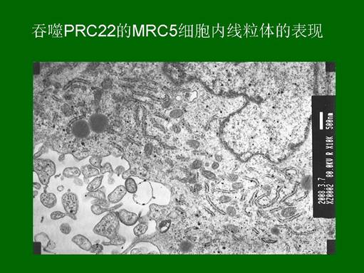 k8凯发官网(中国)天生赢家·一触即发