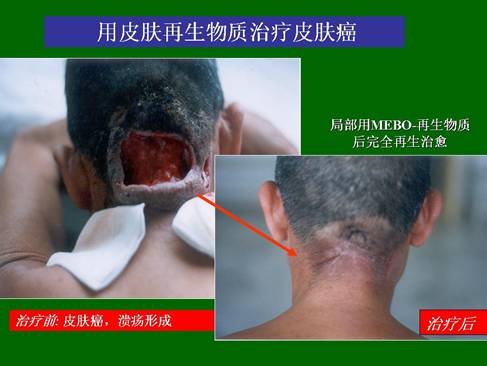 k8凯发官网(中国)天生赢家·一触即发