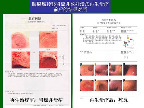 k8凯发官网(中国)天生赢家·一触即发