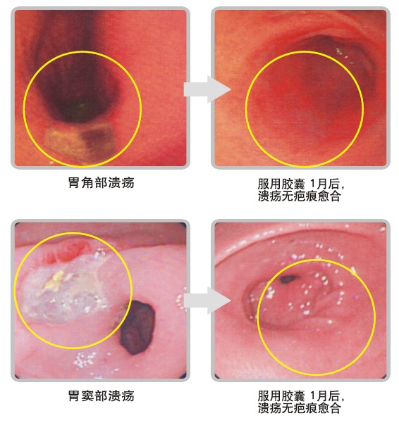 k8凯发官网(中国)天生赢家·一触即发