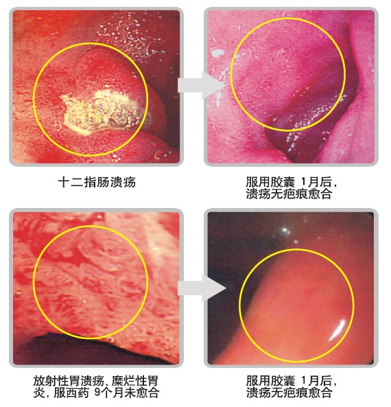 k8凯发官网(中国)天生赢家·一触即发