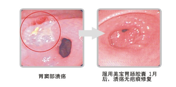 k8凯发官网(中国)天生赢家·一触即发