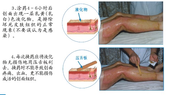 k8凯发官网(中国)天生赢家·一触即发