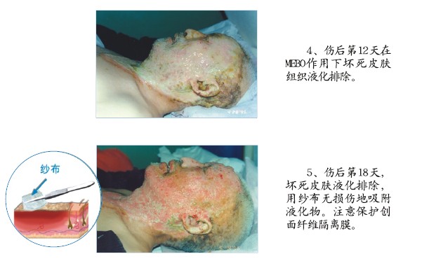 k8凯发官网(中国)天生赢家·一触即发
