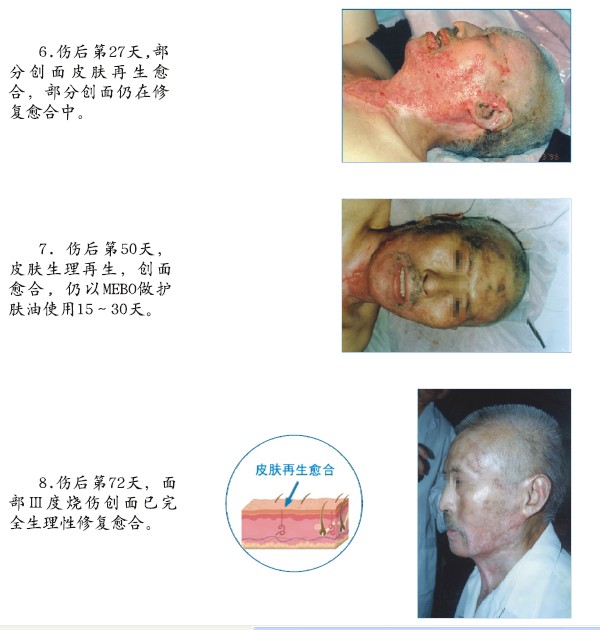 k8凯发官网(中国)天生赢家·一触即发