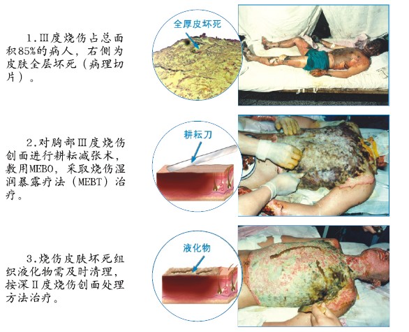 k8凯发官网(中国)天生赢家·一触即发