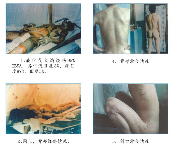 k8凯发官网(中国)天生赢家·一触即发