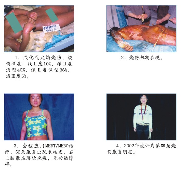 k8凯发官网(中国)天生赢家·一触即发