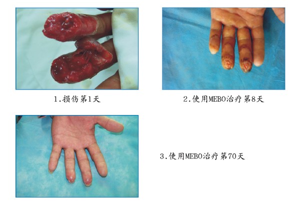 k8凯发官网(中国)天生赢家·一触即发