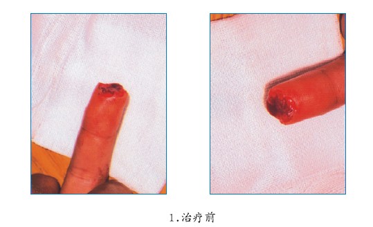k8凯发官网(中国)天生赢家·一触即发