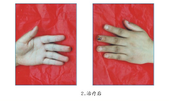 k8凯发官网(中国)天生赢家·一触即发