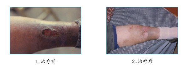 k8凯发官网(中国)天生赢家·一触即发