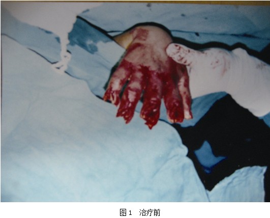 k8凯发官网(中国)天生赢家·一触即发