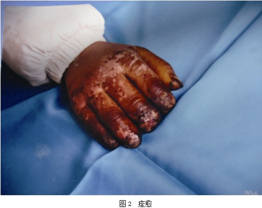 k8凯发官网(中国)天生赢家·一触即发