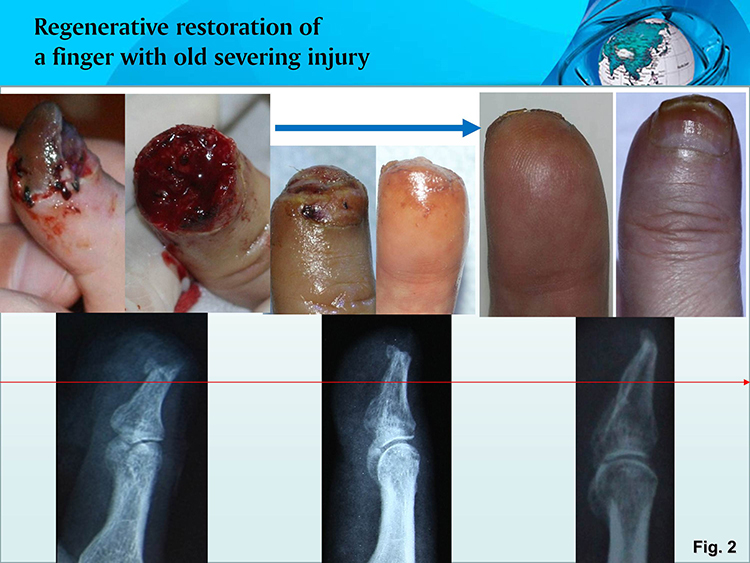k8凯发官网(中国)天生赢家·一触即发