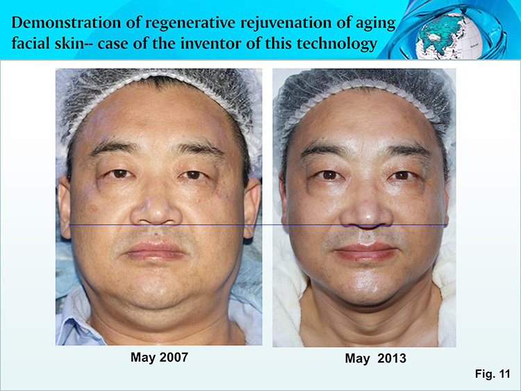 k8凯发官网(中国)天生赢家·一触即发