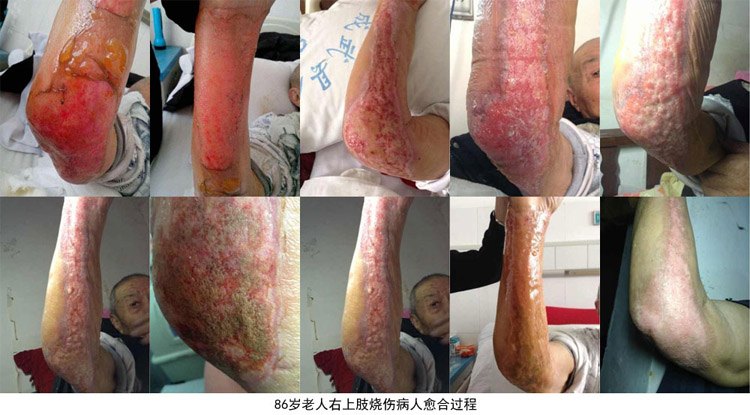 k8凯发官网(中国)天生赢家·一触即发