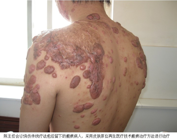 k8凯发官网(中国)天生赢家·一触即发