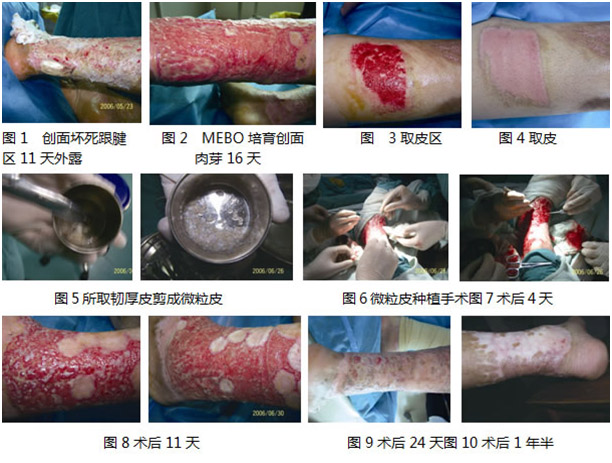 k8凯发官网(中国)天生赢家·一触即发
