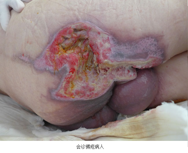 k8凯发官网(中国)天生赢家·一触即发