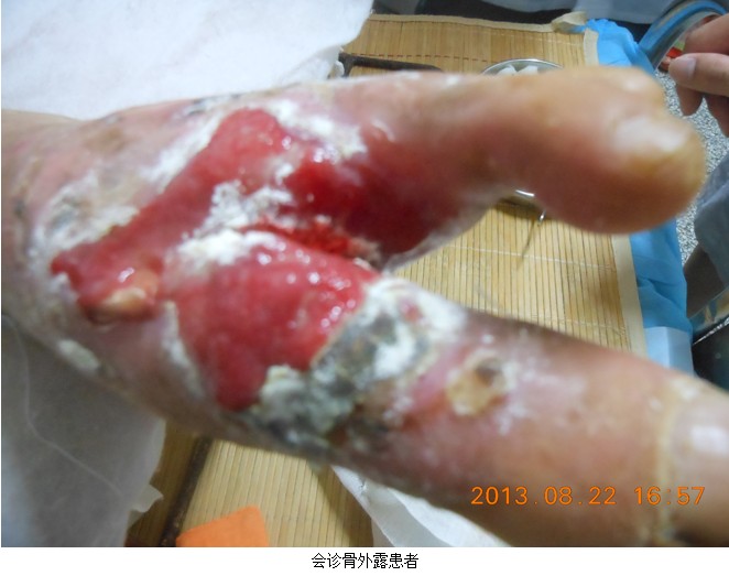 k8凯发官网(中国)天生赢家·一触即发