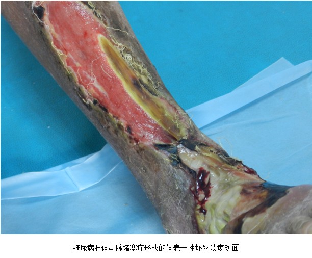 k8凯发官网(中国)天生赢家·一触即发