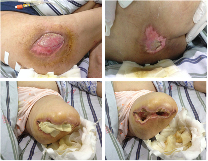 k8凯发官网(中国)天生赢家·一触即发