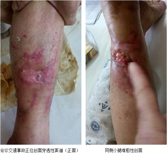 k8凯发官网(中国)天生赢家·一触即发