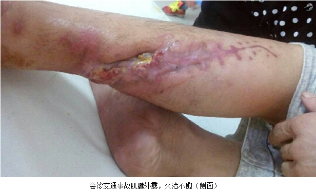 k8凯发官网(中国)天生赢家·一触即发