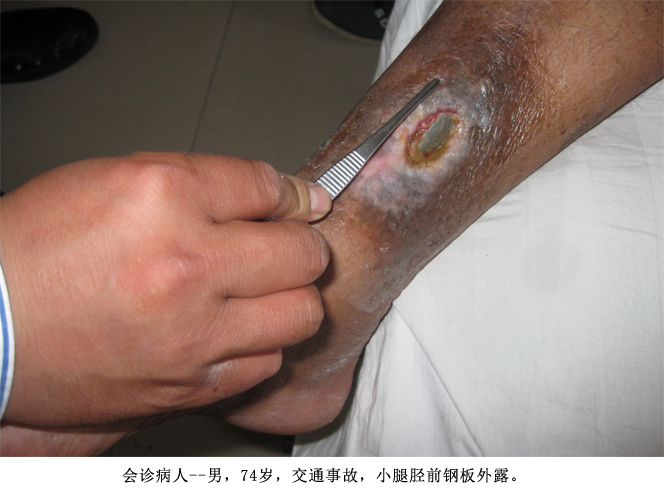 k8凯发官网(中国)天生赢家·一触即发