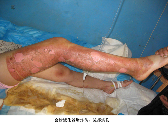 k8凯发官网(中国)天生赢家·一触即发