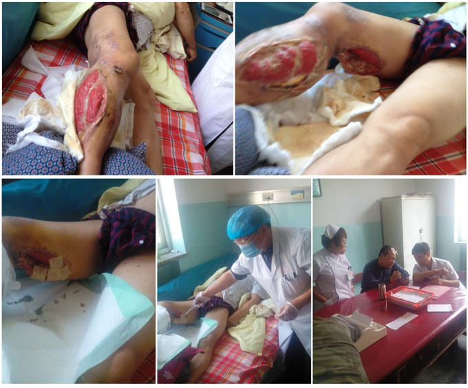 k8凯发官网(中国)天生赢家·一触即发