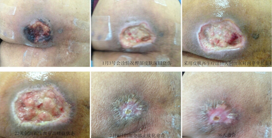 k8凯发官网(中国)天生赢家·一触即发