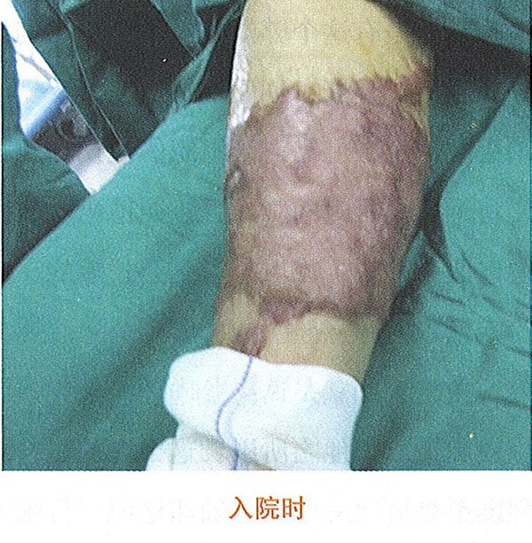 k8凯发官网(中国)天生赢家·一触即发