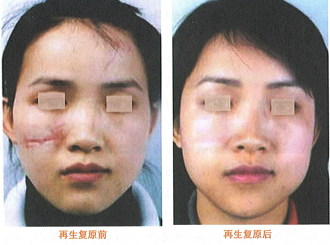 k8凯发官网(中国)天生赢家·一触即发