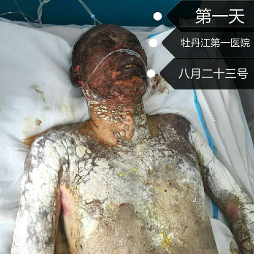 k8凯发官网(中国)天生赢家·一触即发