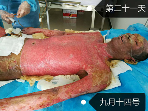 k8凯发官网(中国)天生赢家·一触即发