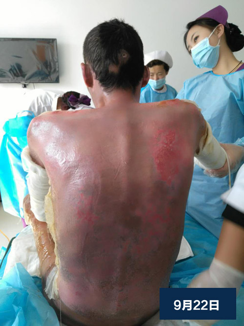 k8凯发官网(中国)天生赢家·一触即发