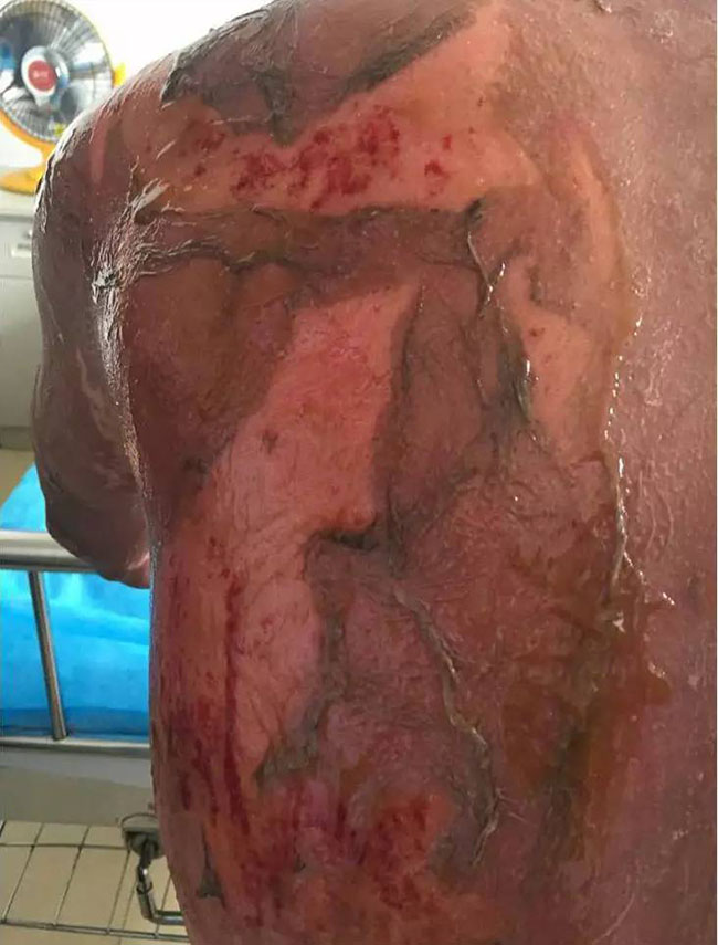 k8凯发官网(中国)天生赢家·一触即发